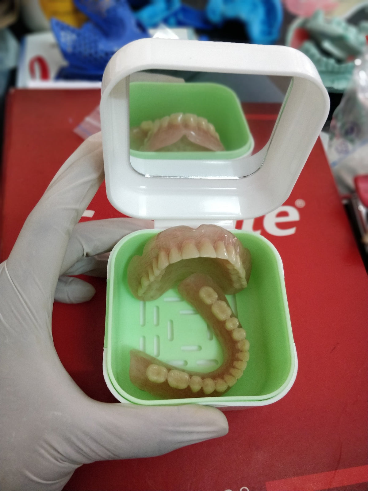 Custom-Fit UPPER AND LOWER COMPLETE DENTURE (FULL ACRYLIC SET)