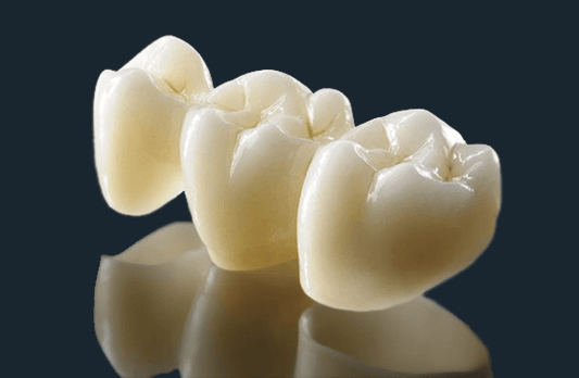 Crown & Bridge Dental Lab All-Ceramic – PFM – Full Cast