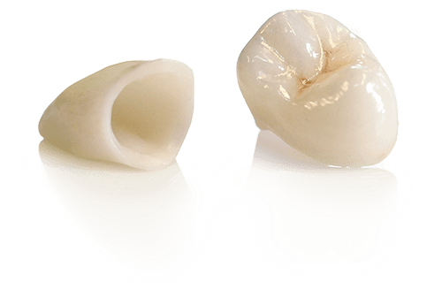 Crown & Bridge Dental Lab All-Ceramic – PFM – Full Cast